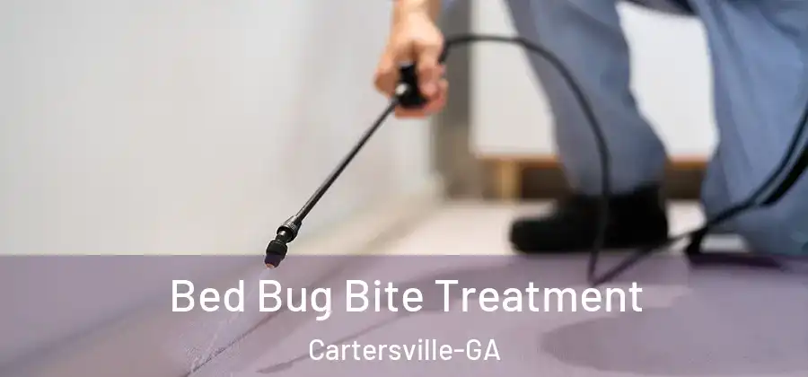  Bed Bug Bite Treatment Cartersville-GA